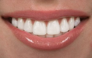 Austin Dentist - Cosmetic Dentistry - Austin Laser Dentist