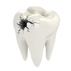 tooth needs restorative dentistry