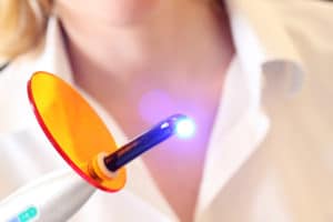 dental laser