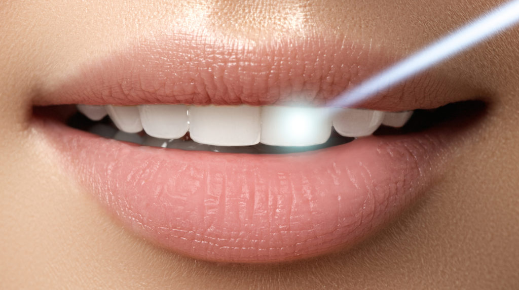 close up of mouth and dental laser