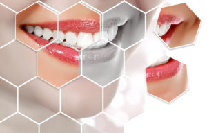 picture of woman's smile with hexagons dividing it