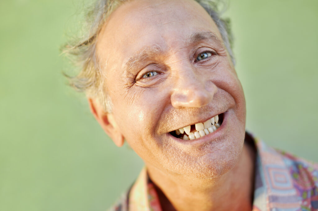 A man with missing teeth smiles broadly