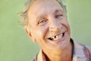 A man with missing teeth smiles broadly