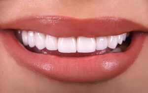 A beautiful smile following restorative dentistry treatments in Austin, TX