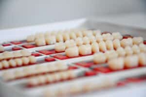 A picture of dental crowns and veneers at an Austin, TX dental center