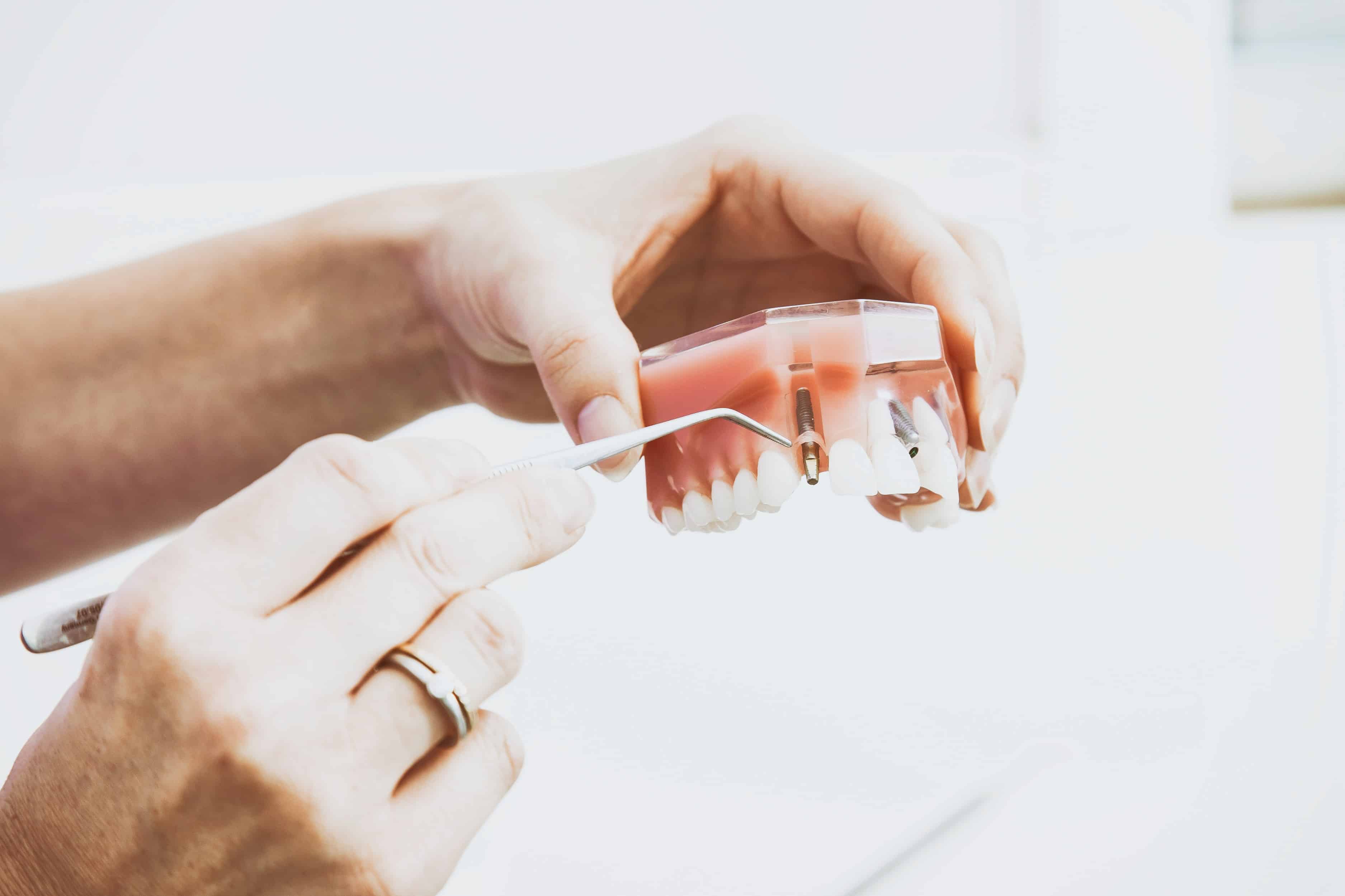 Are Dental Implants Right For Me? - Austin Laser Dentist - Helen ...