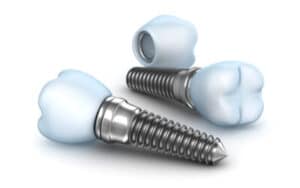 dental implants and dental crowns on white background