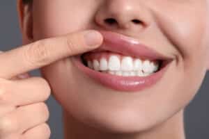 Young woman showing healthy gums on grey background, closeup