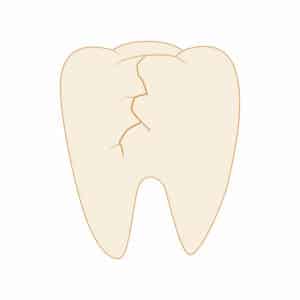 Cracked tooth icon in cartoon style on a white background