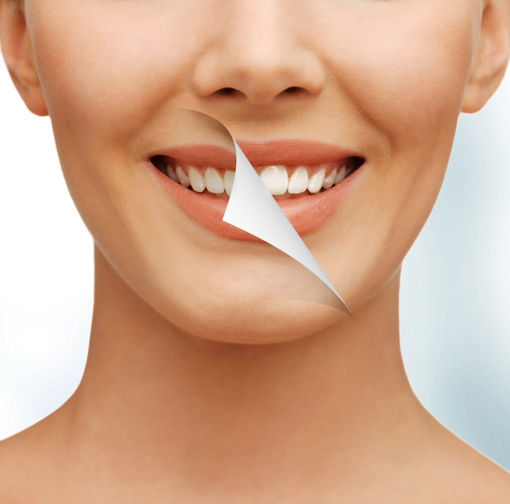 teeth whitening Austin TX patient